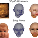 Image for article titled You Can Now Buy a Life-Size, 3D-Printed Replica of Your Unborn Fetus